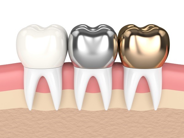 Dental Crown Restore